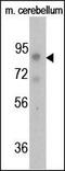 Fibroblast Growth Factor Receptor 1 antibody, PA5-12595, Invitrogen Antibodies, Western Blot image 