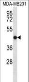 Transmembrane Protein 43 antibody, LS-C162011, Lifespan Biosciences, Western Blot image 