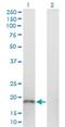 Biorientation Of Chromosomes In Cell Division 1 Like 2 antibody, H00284257-M01, Novus Biologicals, Western Blot image 