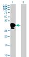 Zinc Finger Protein 396 antibody, H00252884-M01, Novus Biologicals, Western Blot image 