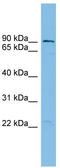 TBC1 Domain Family Member 16 antibody, TA344160, Origene, Western Blot image 