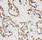 Paxillin antibody, PA1804, Boster Biological Technology, Immunohistochemistry paraffin image 