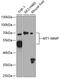 Matrix Metallopeptidase 14 antibody, GTX54361, GeneTex, Western Blot image 