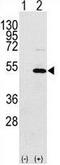 Y-Box Binding Protein 1 antibody, GTX81909, GeneTex, Western Blot image 