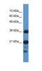 SUZ RNA Binding Domain Containing 1 antibody, NBP1-57737, Novus Biologicals, Enzyme Linked Immunosorbent Assay image 