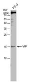 VIP peptides antibody, PA5-78224, Invitrogen Antibodies, Western Blot image 