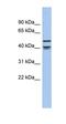 Apolipoprotein B MRNA Editing Enzyme Catalytic Polypeptide Like 4 antibody, orb330817, Biorbyt, Western Blot image 