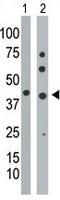 Phosphoglycerate Kinase 1 antibody, ab38007, Abcam, Western Blot image 