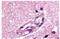 Apelin Receptor antibody, GTX13267, GeneTex, Immunohistochemistry paraffin image 