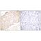 SUMO Specific Peptidase 1 antibody, A02156, Boster Biological Technology, Immunohistochemistry paraffin image 