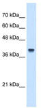 Interferon Induced Protein 44 Like antibody, TA339304, Origene, Western Blot image 