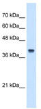 Interferon-induced protein 44-like antibody, TA339304, Origene, Western Blot image 