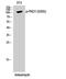 Protein Kinase D1 antibody, A01455S205-1, Boster Biological Technology, Western Blot image 