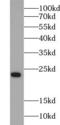 RAB1B, Member RAS Oncogene Family antibody, FNab07001, FineTest, Western Blot image 