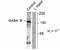 Gamma-Aminobutyric Acid Type B Receptor Subunit 1 antibody, GTX31018, GeneTex, Western Blot image 