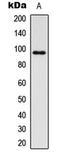 Insulin Like Growth Factor 1 Receptor antibody, LS-C358783, Lifespan Biosciences, Western Blot image 