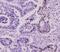 Small Ubiquitin Like Modifier 2 antibody, NBP2-22546, Novus Biologicals, Immunohistochemistry paraffin image 