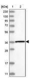 PHD Finger Protein 7 antibody, NBP1-81674, Novus Biologicals, Western Blot image 