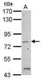 Amiloride-sensitive sodium channel subunit alpha antibody, PA5-29136, Invitrogen Antibodies, Western Blot image 