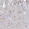 Galactosidase Beta 1 Like 3 antibody, NBP2-48716, Novus Biologicals, Immunohistochemistry frozen image 