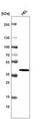 H2A Histone Family Member Y antibody, NBP2-61155, Novus Biologicals, Western Blot image 
