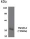 TNF Superfamily Member 14 antibody, GTX52911, GeneTex, Western Blot image 