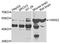 Tyrosyl-TRNA Synthetase 2 antibody, STJ110283, St John