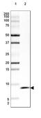 Immediate Early Response 3 Interacting Protein 1 antibody, NBP1-90884, Novus Biologicals, Western Blot image 