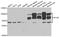 SP100 Nuclear Antigen antibody, A5851, ABclonal Technology, Western Blot image 