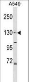 Collagen alpha-6(IV) chain antibody, LS-C159388, Lifespan Biosciences, Western Blot image 