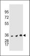 TNKS antibody, LS-C203764, Lifespan Biosciences, Western Blot image 