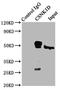 Casein kinase I isoform delta antibody, LS-C375538, Lifespan Biosciences, Immunoprecipitation image 