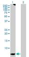 Glutamic-Oxaloacetic Transaminase 1 antibody, H00002788-D01P, Novus Biologicals, Western Blot image 