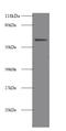 Alkaline Phosphatase, Intestinal antibody, MBS719437, MyBioSource, Western Blot image 