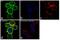 Spleen Associated Tyrosine Kinase antibody, PA5-27262, Invitrogen Antibodies, Immunofluorescence image 
