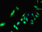 Protein Phosphatase, Mg2+/Mn2+ Dependent 1B antibody, LS-B11253, Lifespan Biosciences, Immunofluorescence image 