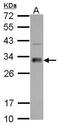 Four And A Half LIM Domains 1 antibody, PA5-32161, Invitrogen Antibodies, Western Blot image 