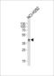 Absent In Melanoma 2 antibody, LS-C204058, Lifespan Biosciences, Western Blot image 