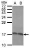 60S acidic ribosomal protein P2 antibody, PA5-27541, Invitrogen Antibodies, Western Blot image 