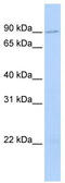 Transmembrane And Coiled-Coil Domain Family 2 antibody, TA344102, Origene, Western Blot image 