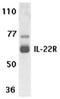 Interleukin 22 Receptor Subunit Alpha 1 antibody, ADI-905-310-100, Enzo Life Sciences, Western Blot image 