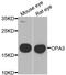 Outer Mitochondrial Membrane Lipid Metabolism Regulator OPA3 antibody, A7997, ABclonal Technology, Western Blot image 
