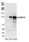 BTB Domain And CNC Homolog 2 antibody, A305-502A, Bethyl Labs, Western Blot image 