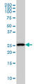 Major Histocompatibility Complex, Class II, DM Alpha antibody, LS-C133242, Lifespan Biosciences, Western Blot image 