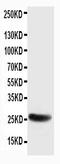 Synaptosome Associated Protein 25 antibody, PA1315, Boster Biological Technology, Western Blot image 