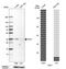 TGFB Induced Factor Homeobox 1 antibody, HPA062160, Atlas Antibodies, Western Blot image 
