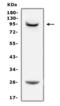 Prolactin Receptor antibody, LS-C313207, Lifespan Biosciences, Western Blot image 