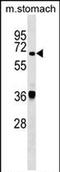 Tyrosyl-DNA Phosphodiesterase 1 antibody, PA5-72009, Invitrogen Antibodies, Western Blot image 