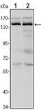 Lysine Demethylase 3A antibody, A03994, Boster Biological Technology, Western Blot image 