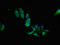 Protein Phosphatase 2 Regulatory Subunit Balpha antibody, LS-C679123, Lifespan Biosciences, Immunofluorescence image 